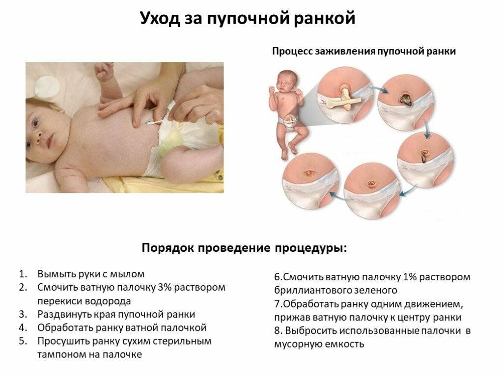 Как подмывать новорожденного ребенка: интимная гигиена для мальчиков и девочек