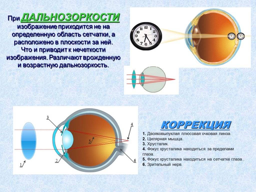 От чего на самом деле портится зрение у детей. 20 вопросов офтальмологу