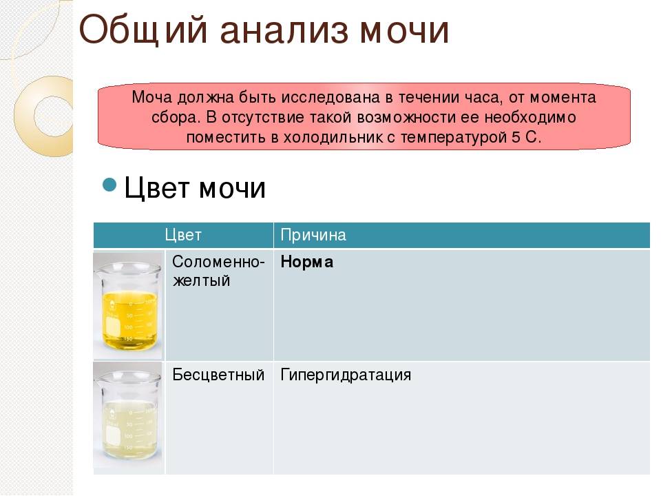 Запах мочи при беременности на ранних и поздних сроках: почему меняется или становится неприятным?