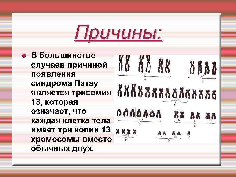 Синдром патау (трисомия 13-й хромосомы): причины и диагностика | планирование беременности