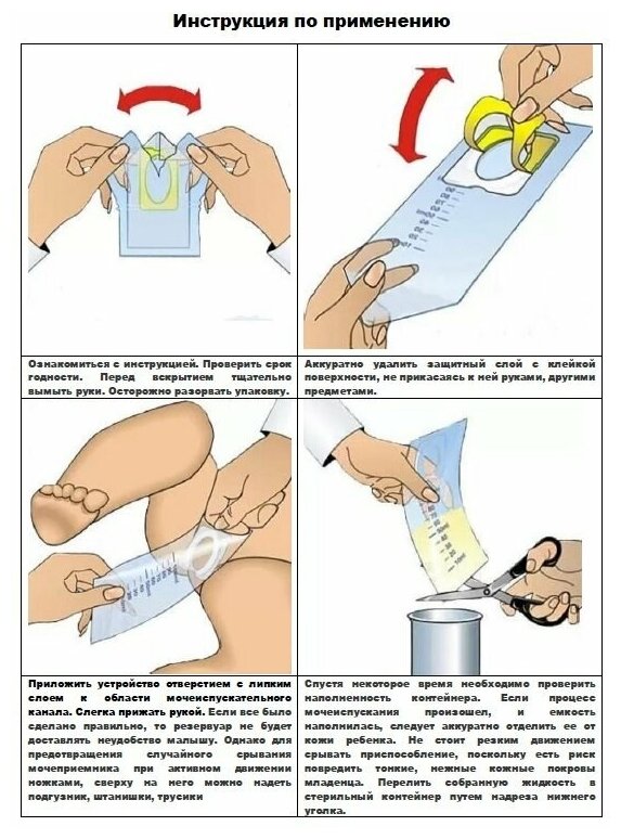 Мочеприемник для новорожденных - как правильно пользоваться
