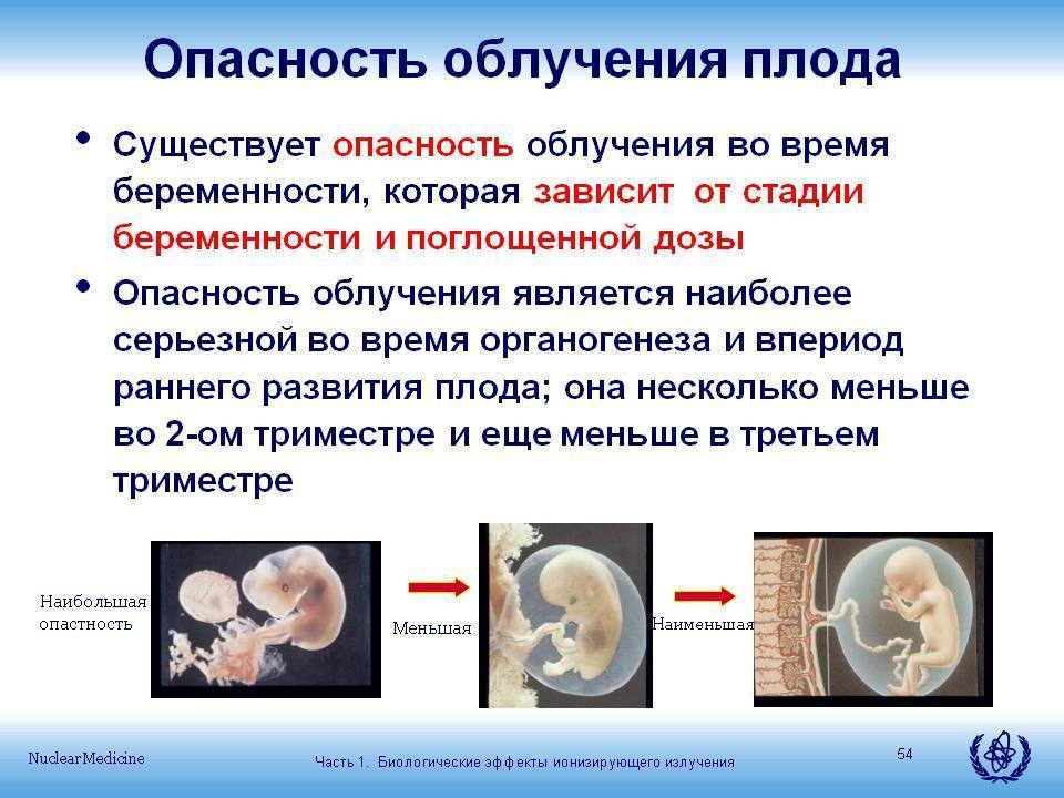 Рентген при беременности: на каких сроках, можно ли делать?