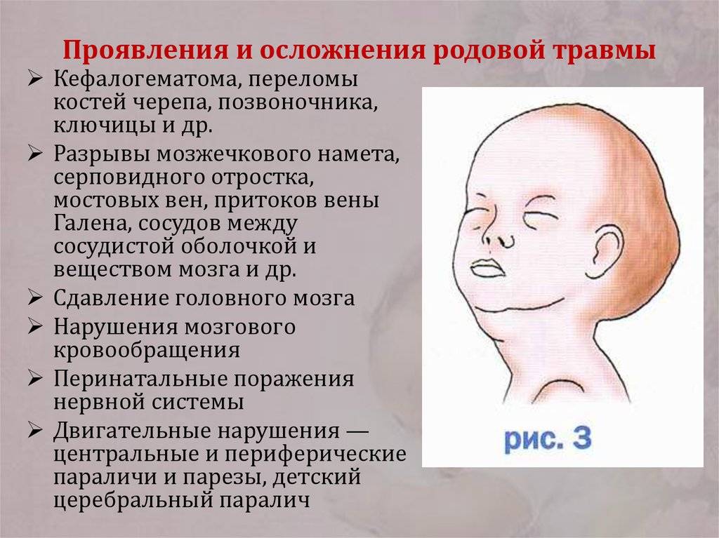 Кефалогематома у новорожденных на голове: лечение, пункция и последствия