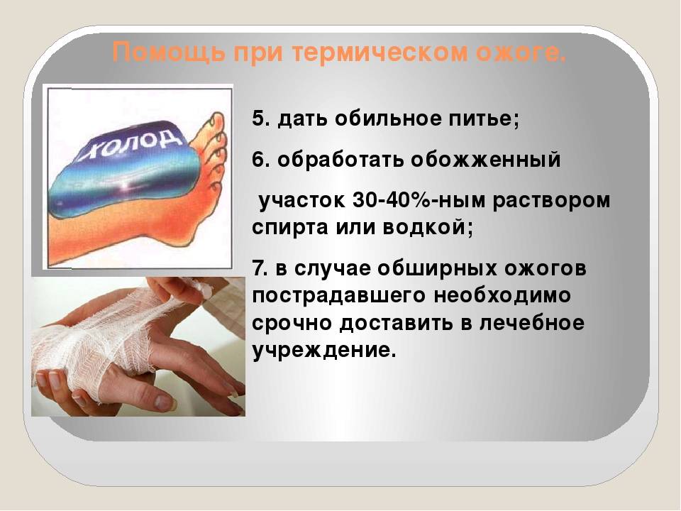 Ожоги у детей – не паникуем, а начинаем лечение!