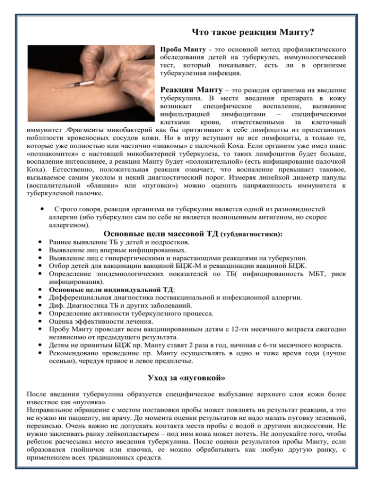 Проведение пробы манту