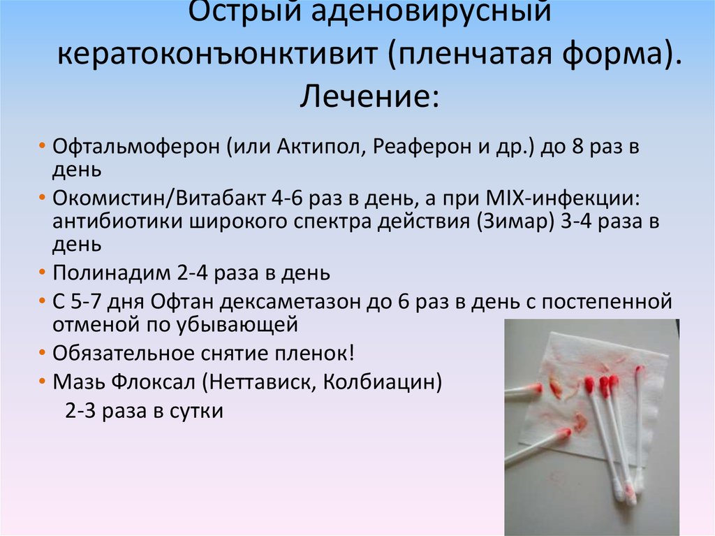 Аденовирусная инфекция у детей и взрослых