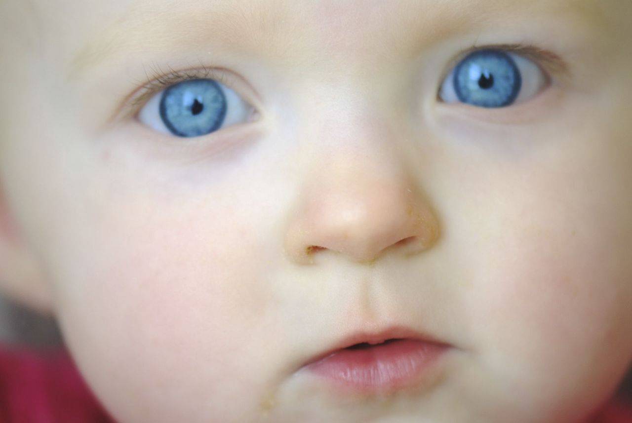 Cиняки под глазами у грудничка — основные причины появления | ru-babyhealth