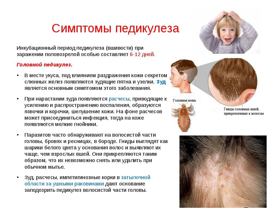 Себорейные корочки на голове у ребенка. как полностью убрать?