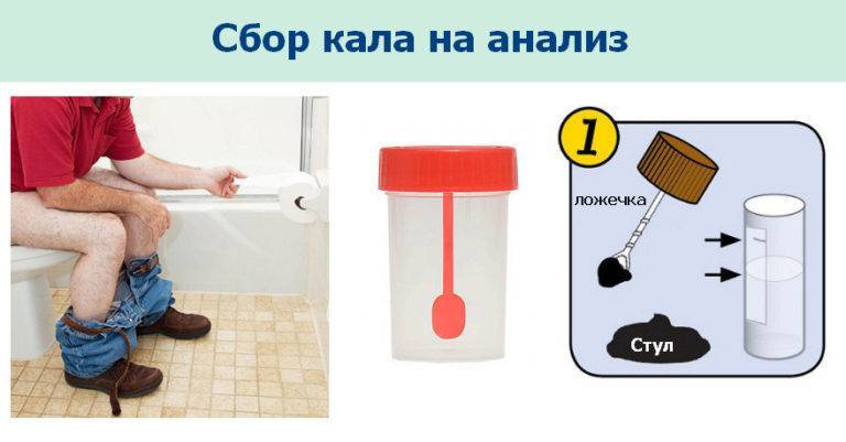 Как и когда собирать кал у грудничка на анализ, чего делать нельзя и как лучше собрать и хранить материал