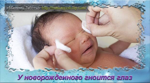 Гноится глазик у новорождённого