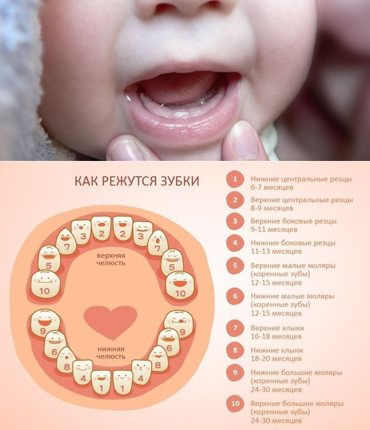 Как облегчить ребёнку боль в период прорезывания зубов: 5 действенных совета