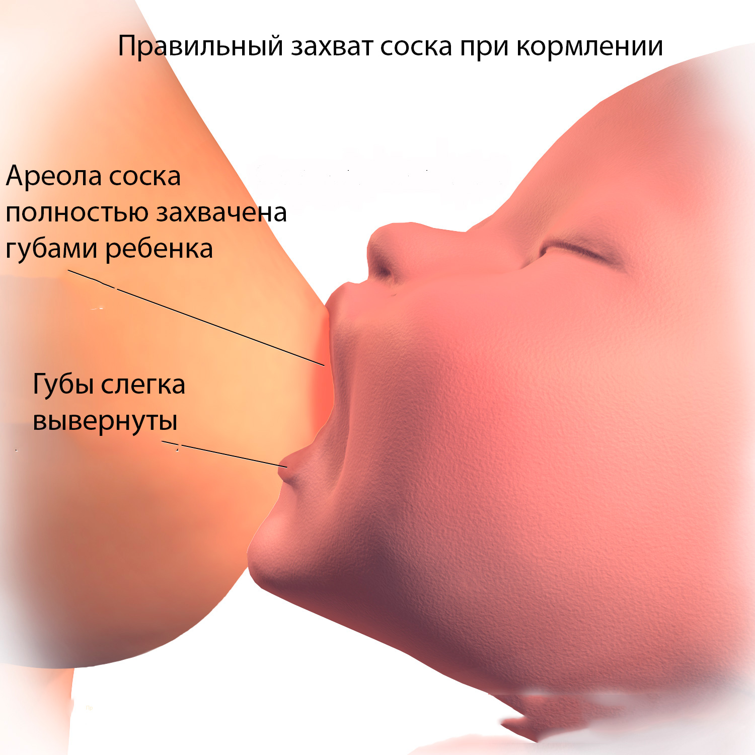 Лактостаз у кормящей матери: симптомы и эффективное лечение в домашних условиях