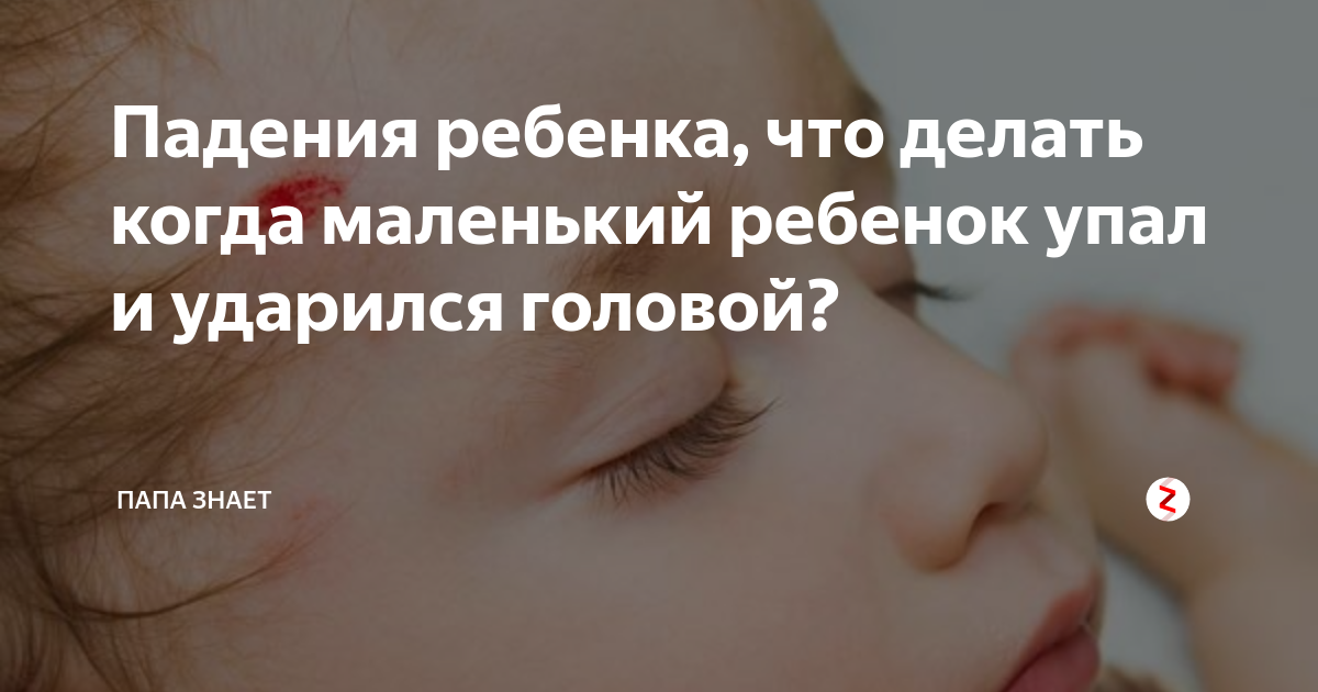 Упал с дивана 8 месяцев. Если ребёнок ударился головой. Что делать если ребенок ударился. Ребенок упал и ударился затылком. Ребёнок 6 месяцев ударился головой.