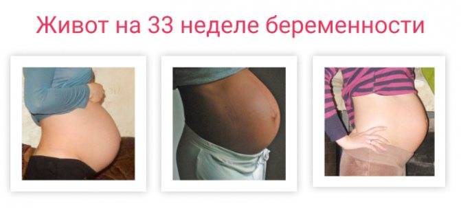 33 недели беременности сильно