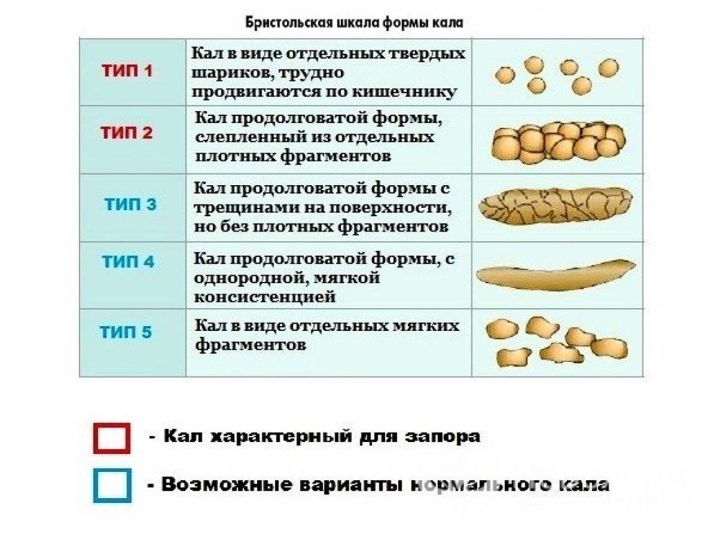Запор у новорожденного при искусственном вскармливании