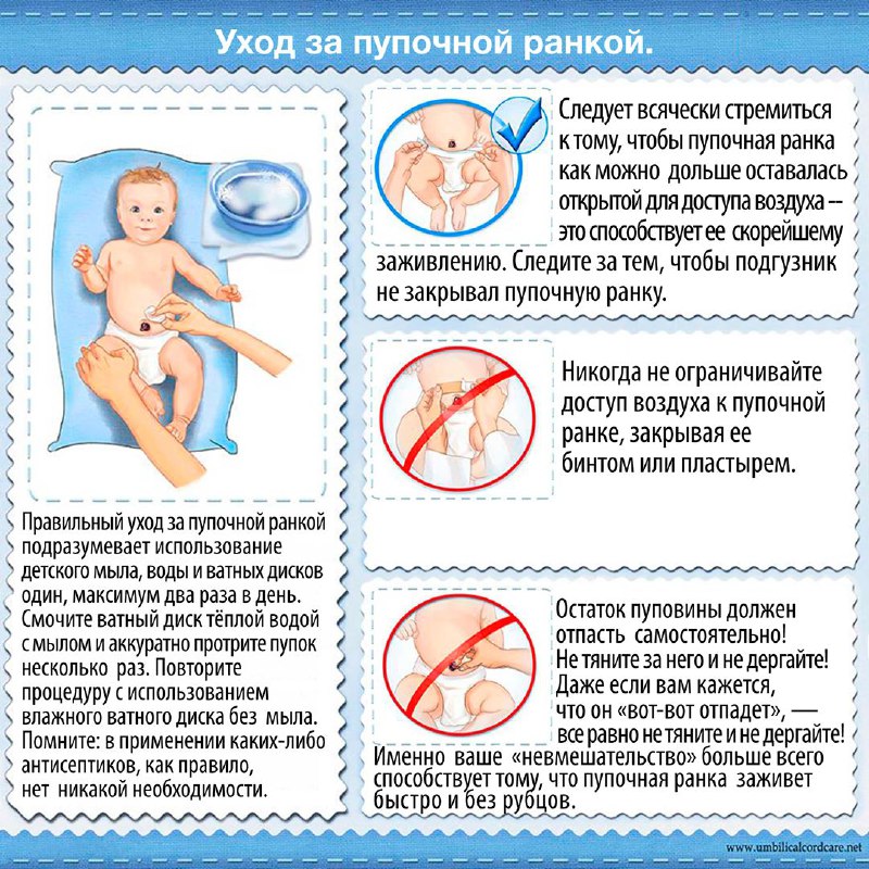 Уход за пупочной ранкой новорожденного - этапы ухода
