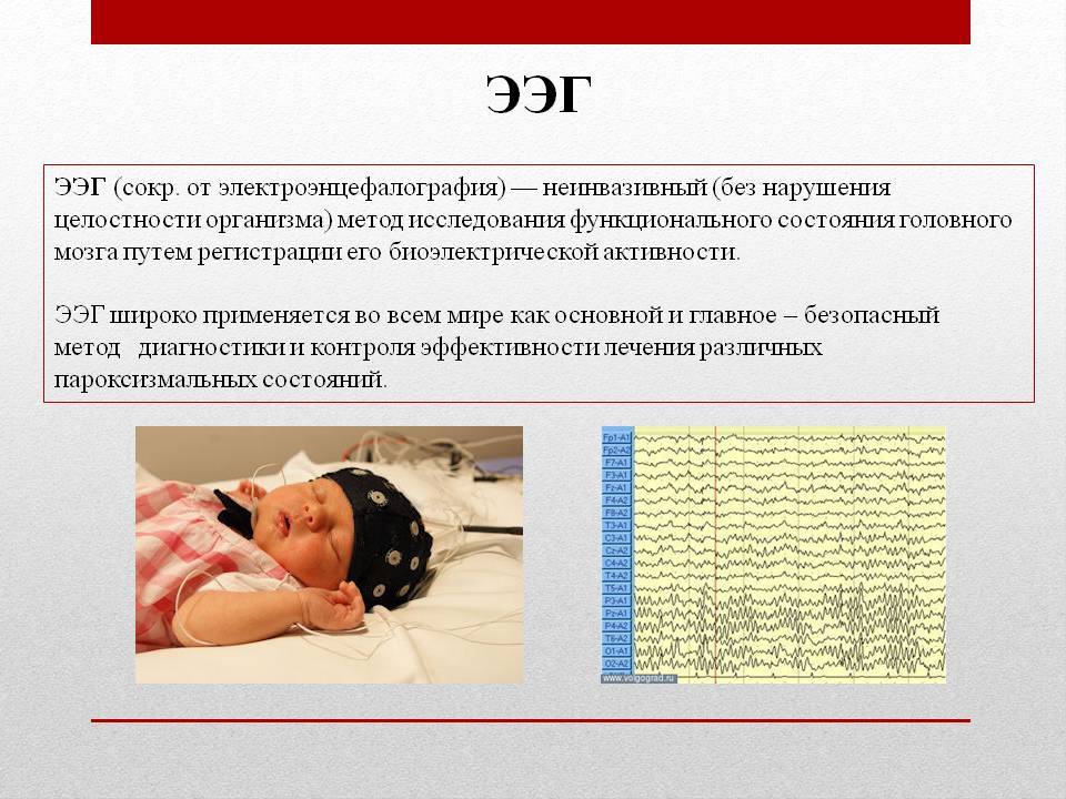 Ээг детям