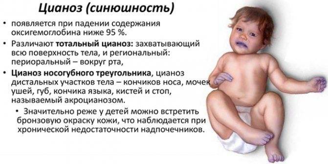 Почему у грудничка синеет носогубный треугольник | ru-babyhealth