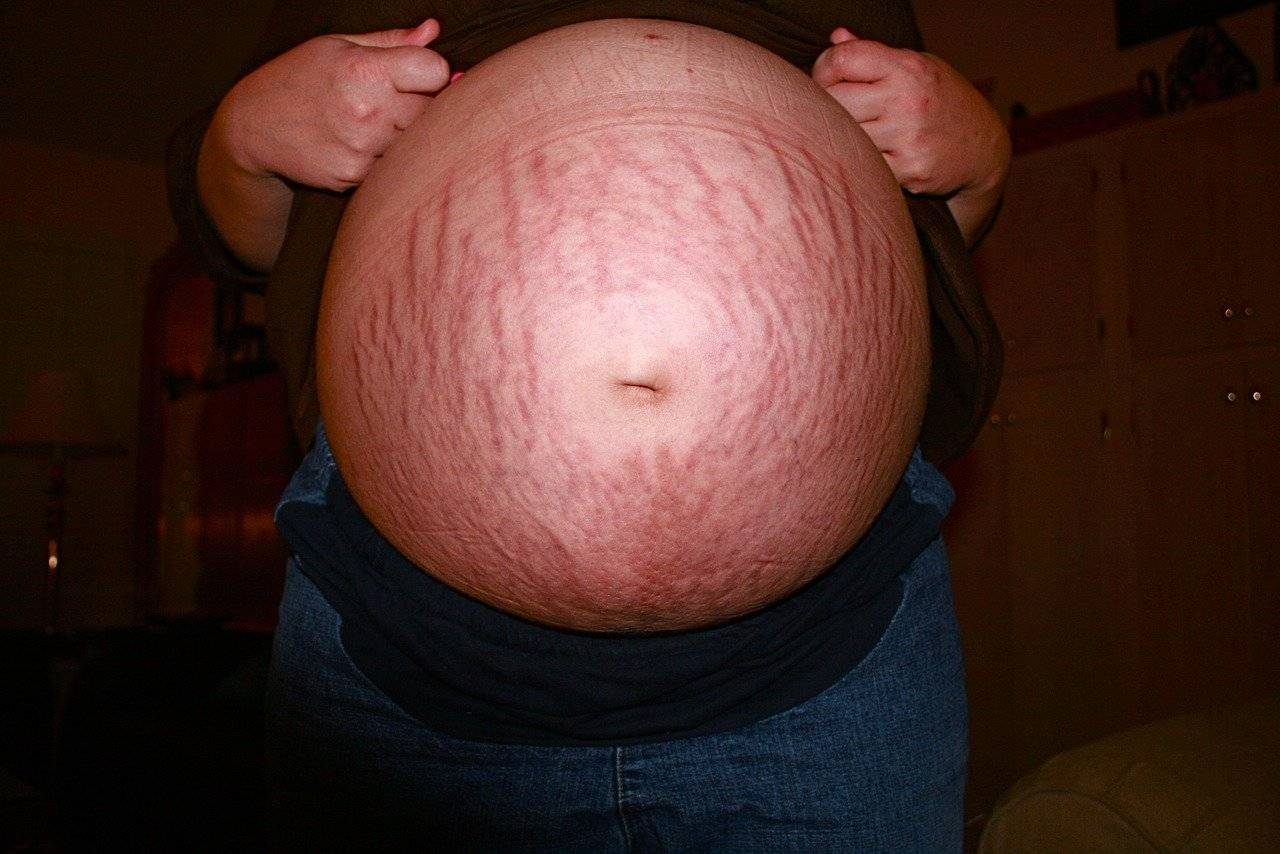 грудь у беременных на ранних сроках фото 44