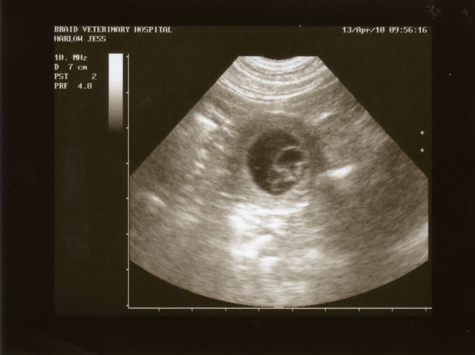 4 недели беременности грудь выделения (120) фото