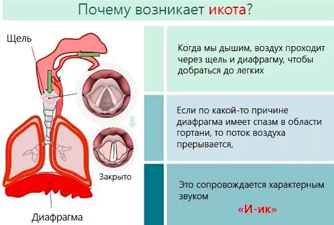 Икота у ребенка: причины, почему ребенок часто икает