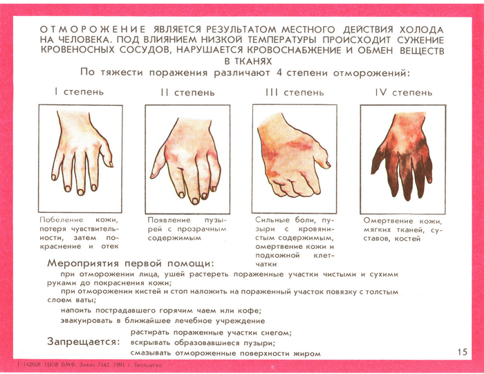Первая помощь при обморожении нижних конечностей