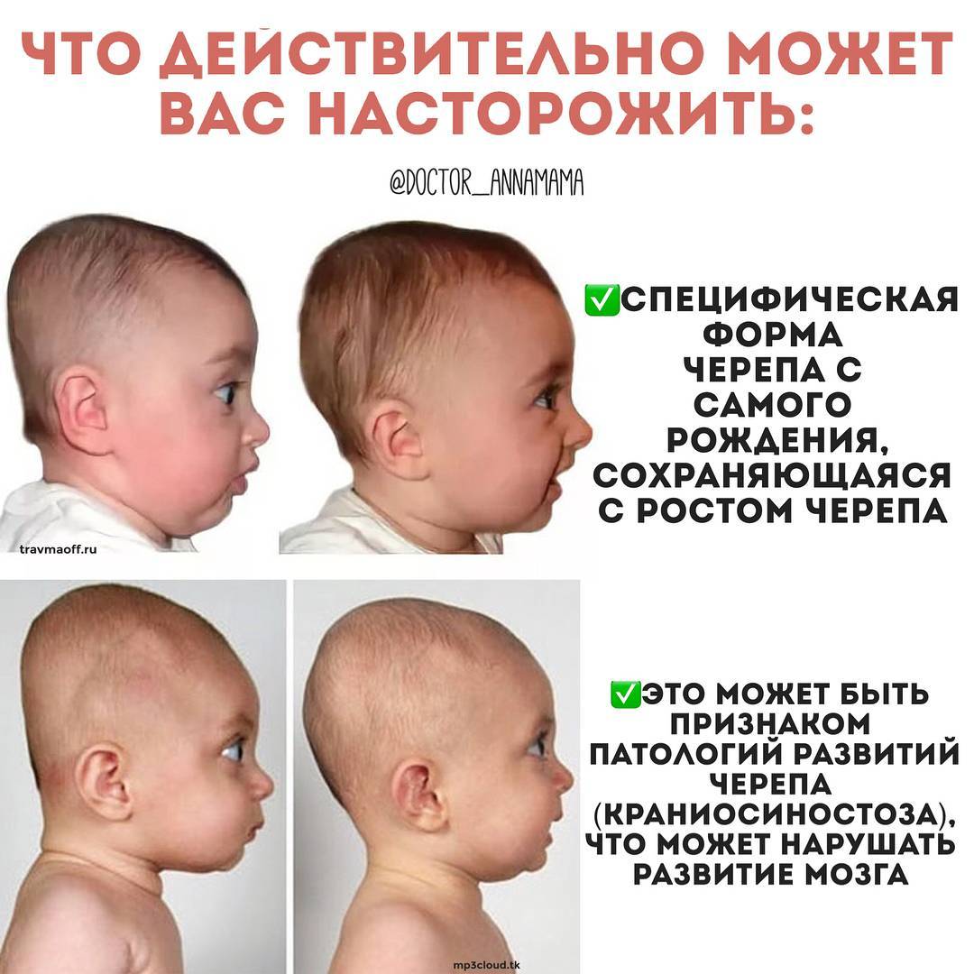Родничок у ребёнка: факты и мифы