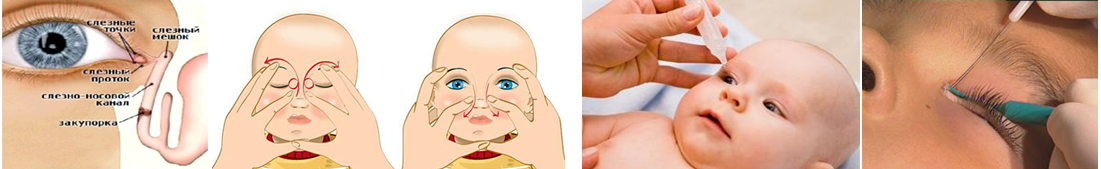 Массаж слезного канала у новорожденных — как массировать глаза грудничку