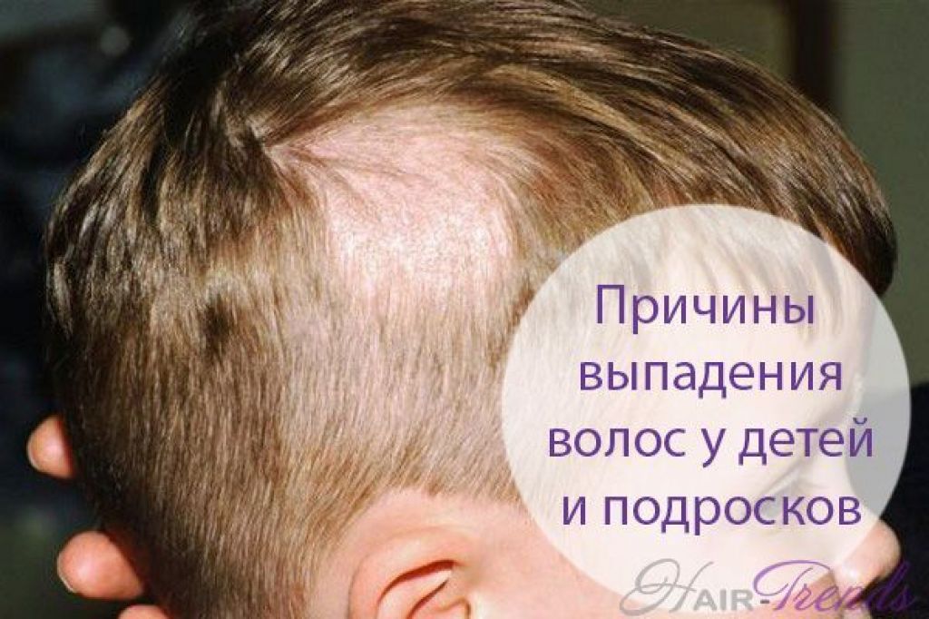 Выпадают волосы у ребенка: причины плохих волос, профилактика