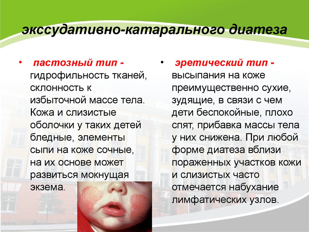 Диатез у детей: симптомы, диагностика и лечение | лдц здоровье