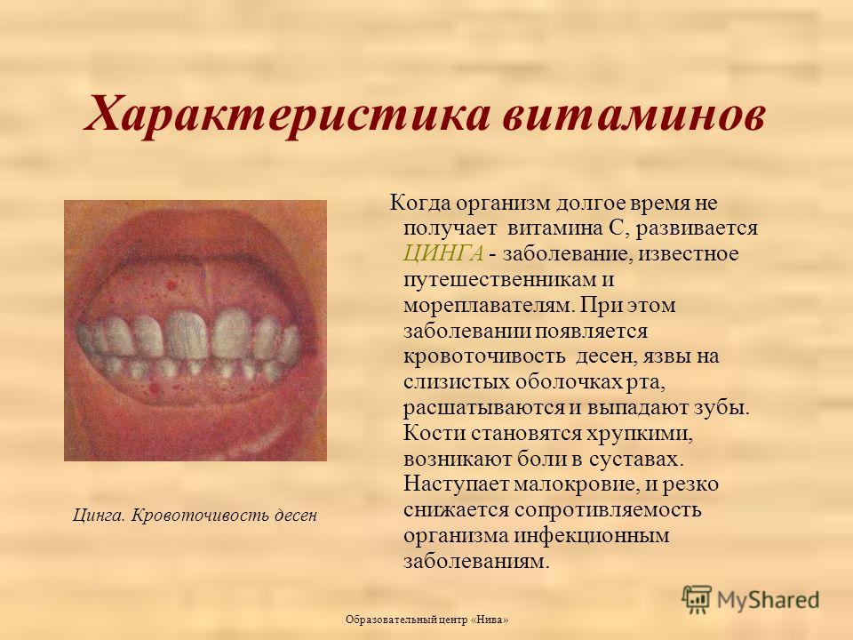 Стоматит у грудничка: симптомы и лечение младенца (с фото)