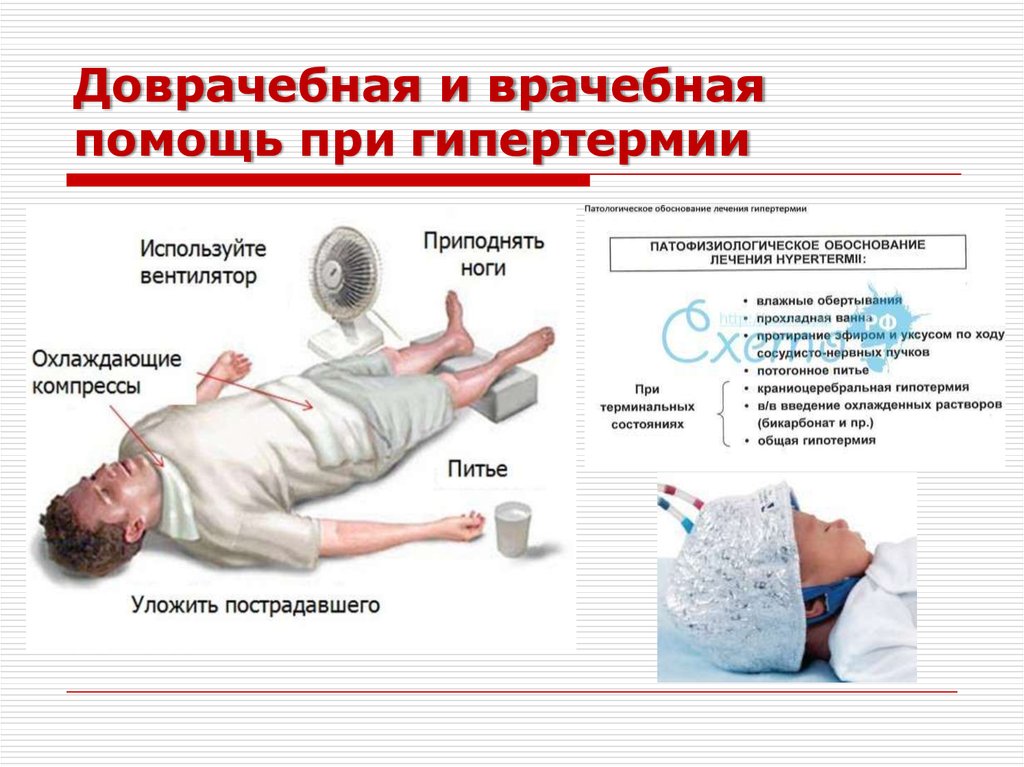 Что делать, если при высокой температуре холодные ноги?