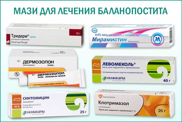 Синехии крайней плоти у мальчиков: виды, причины, симптомы, диагностика и лечение