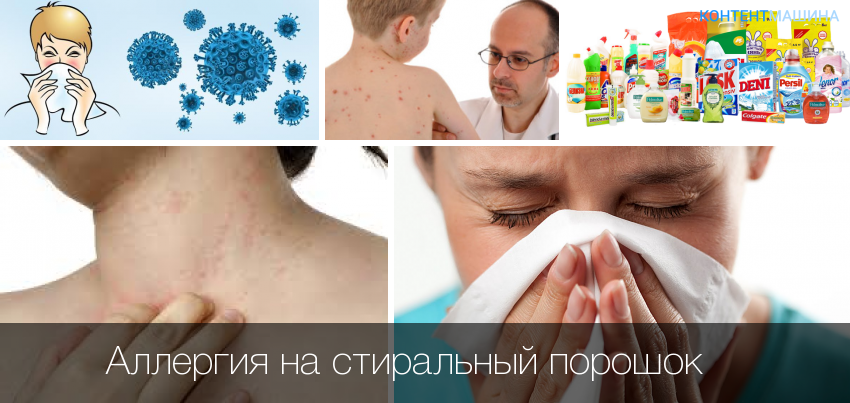 Аллергия у грудничка: симптомы и лечение