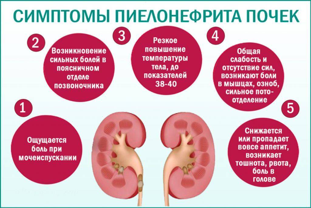 Пиелонефрит у грудничков: симптомы, причины, диагностика и лечение заболевания у детей до года