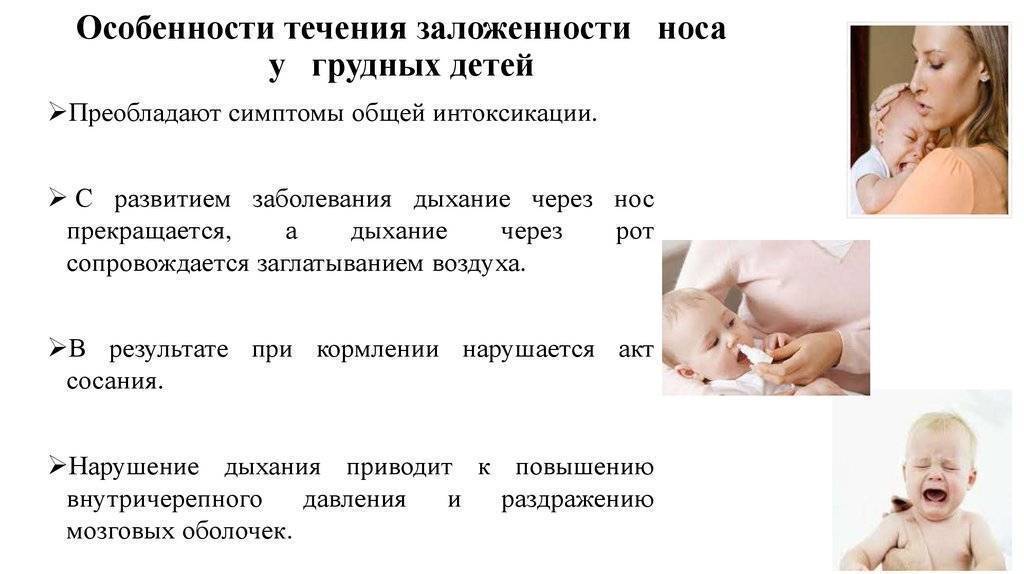 Насморк у детей. причины, стадии развития, симптомы и лечение насморка у детей
