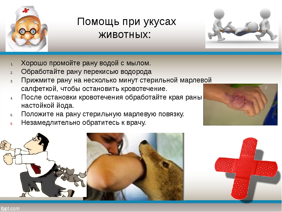 Собака укусила ребенка: первая помощь и инструкция по примирению. советы, как наказать хозяина
