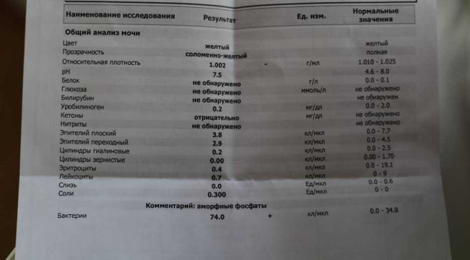 Нитриты в моче: причины повышения и лечение