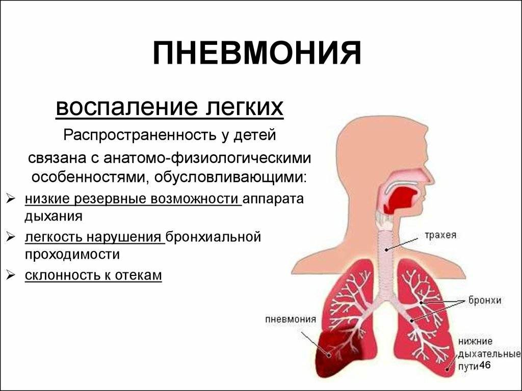 Пневмония у новорожденных: причины, симптомы, лечение