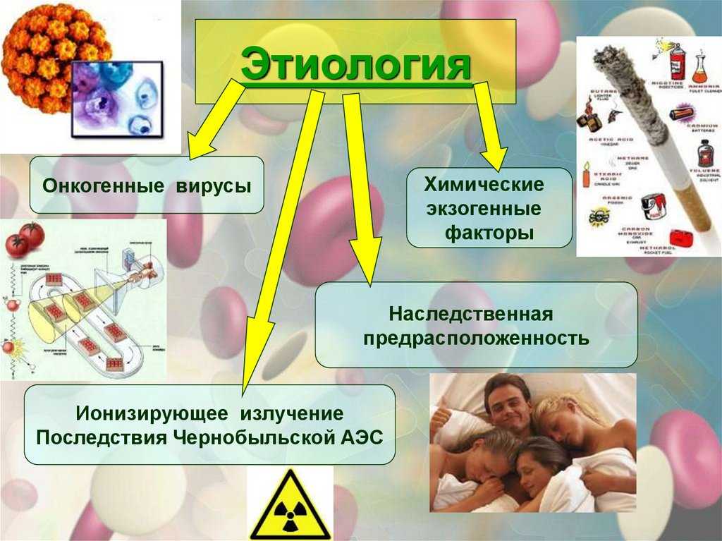 Острый лейкоз (острая лейкемия)