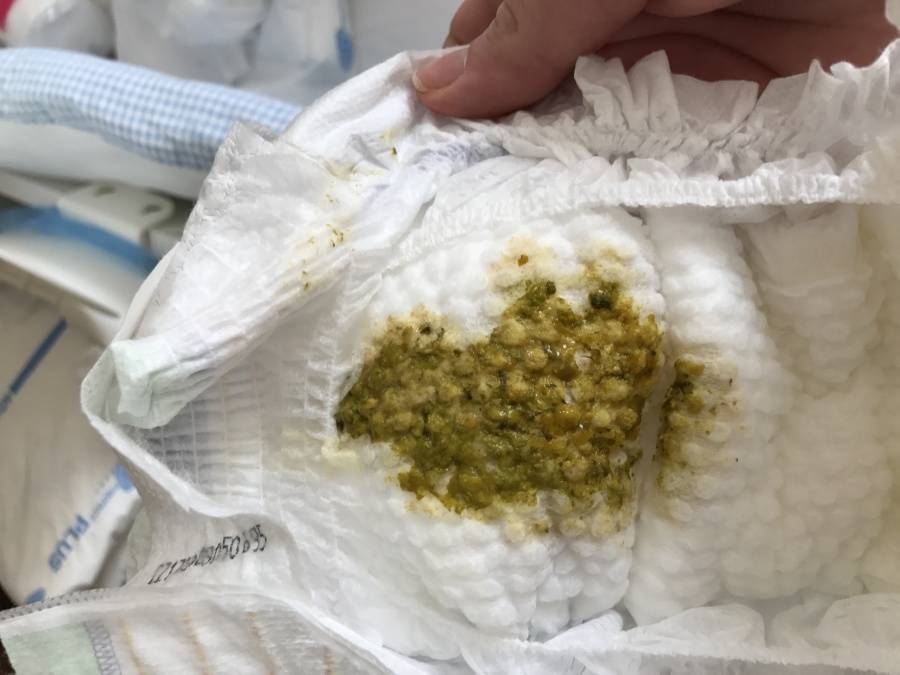 Запоры и колики у грудных детей