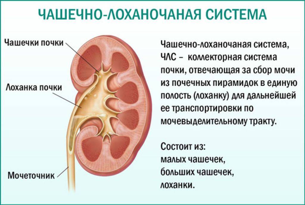 Расширена (увеличена) лоханка почки у новорождённых детей: особенности пиелоэктазии, причины, симптомы и методы лечения