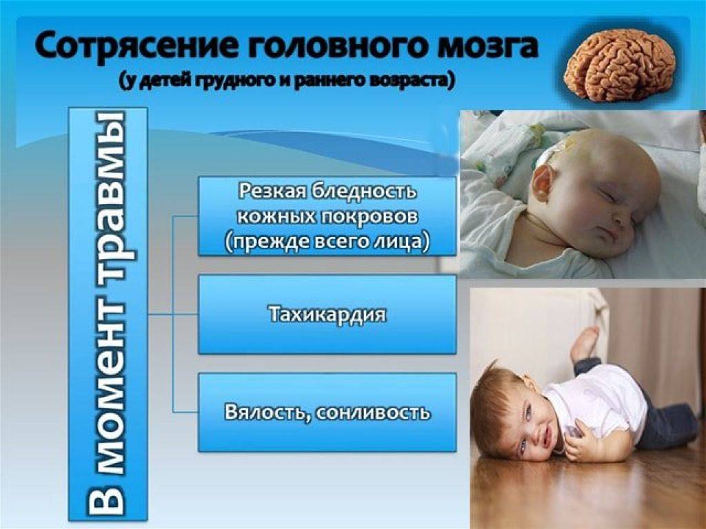 Признаки сотрясения у ребенка до года после падения с кровати