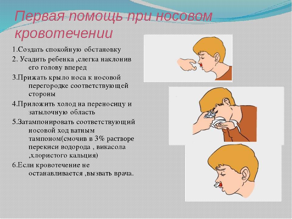 Кровь из носа у ребенка: 22 причины почему она идет и как остановить