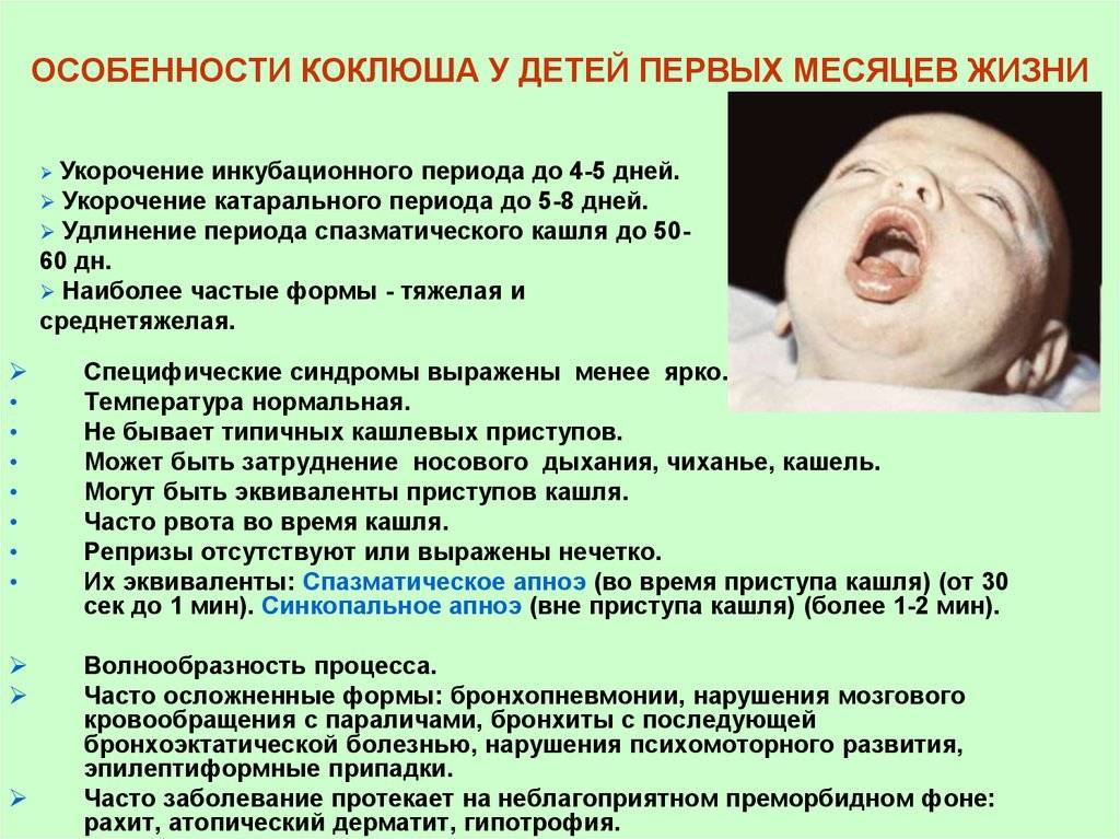Коклюш у детей до года: симптомы, формы заболевания, методы лечения и профилактики