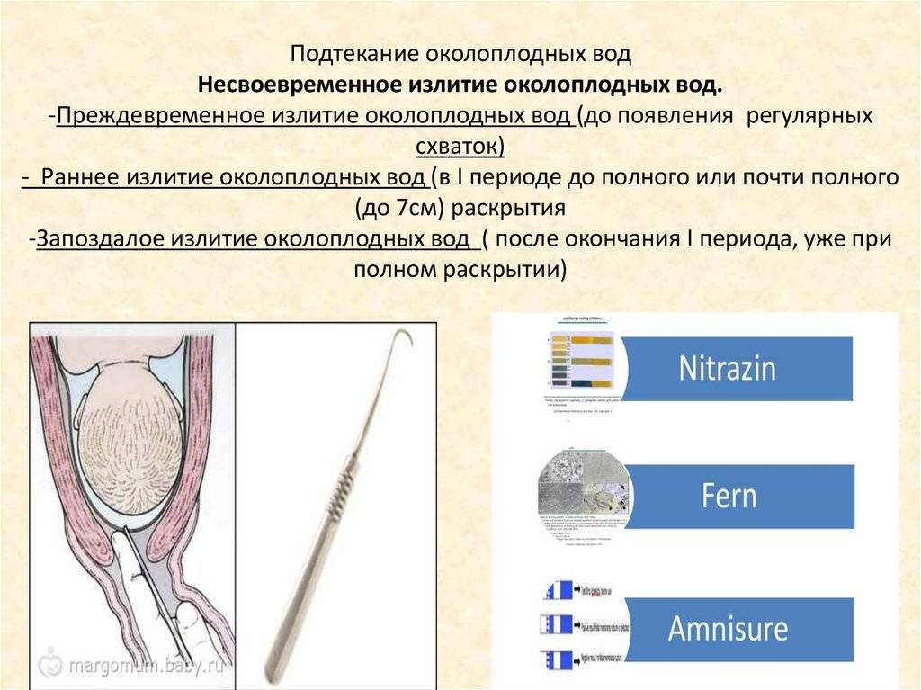 Подтекание околоплодных вод фото Признаки подтекания околоплодных вод