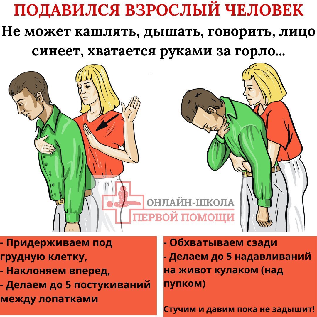 Способ спасти его читать. Человек подавился. Если человек подавился и задыхается. Человек подавился первая помощь. Человек подавился и задыхается первая.