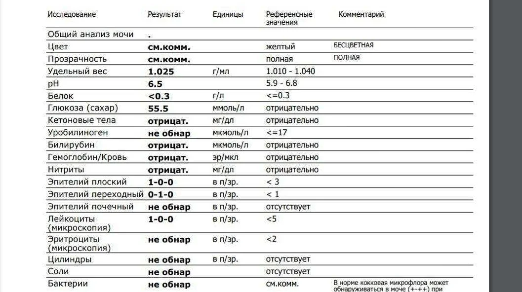 анализ мочи при сахарном диабете определяется