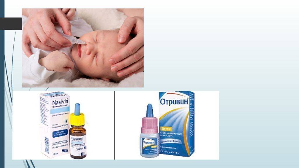 Насморк у новорожденного: как и чем лечить ринит у грудничка