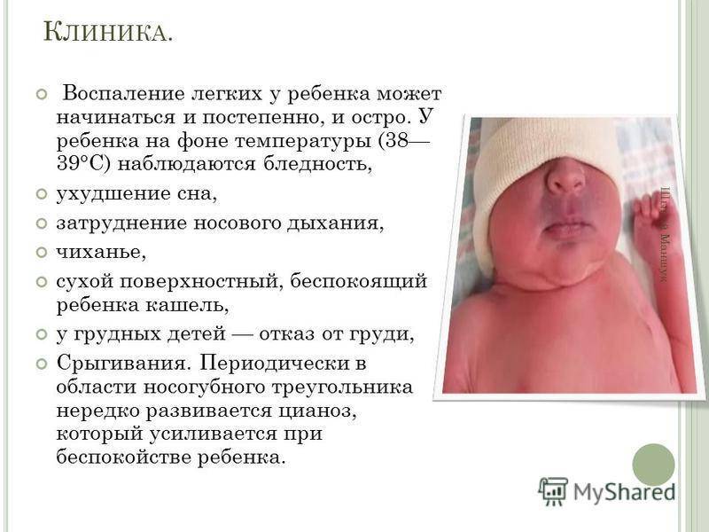Пневмония у новорожденных - симптомы, лечение, причины, последствия